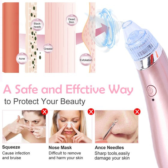 Blackhead Remover (Vacuum Skin Cleanser)